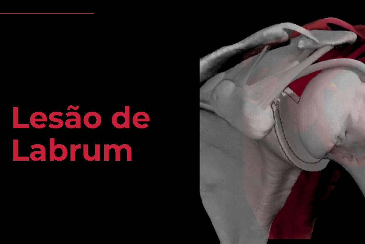 tratamento lesao de labrum florianopolis