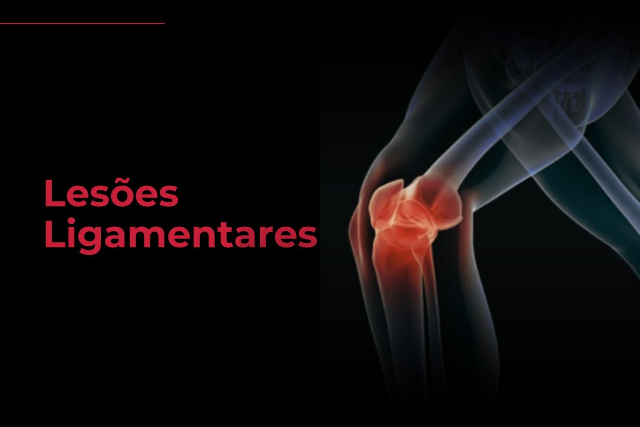 lesoes ligamentares - Reab fisioterapia florianopolis